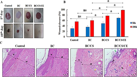 Synthesis and Characterization of Cellulose Nanofibers/Chitosan/Cinnamon Extract Wound Dressing With Significant Antibacterial and Wound Healing Properties