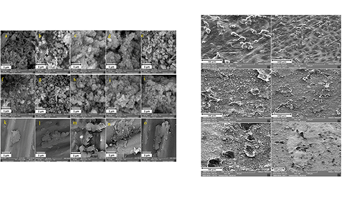 Electrophoretic Deposition of Biphasic Calcium Phosphate/Graphene Nanocomposite Coatings on Ti6al4v Substrate for Biomedical Applications