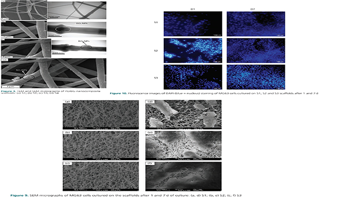 Novel Electrospun Polyurethane Scaffolds Containing Bioactive Glass Nanoparticles