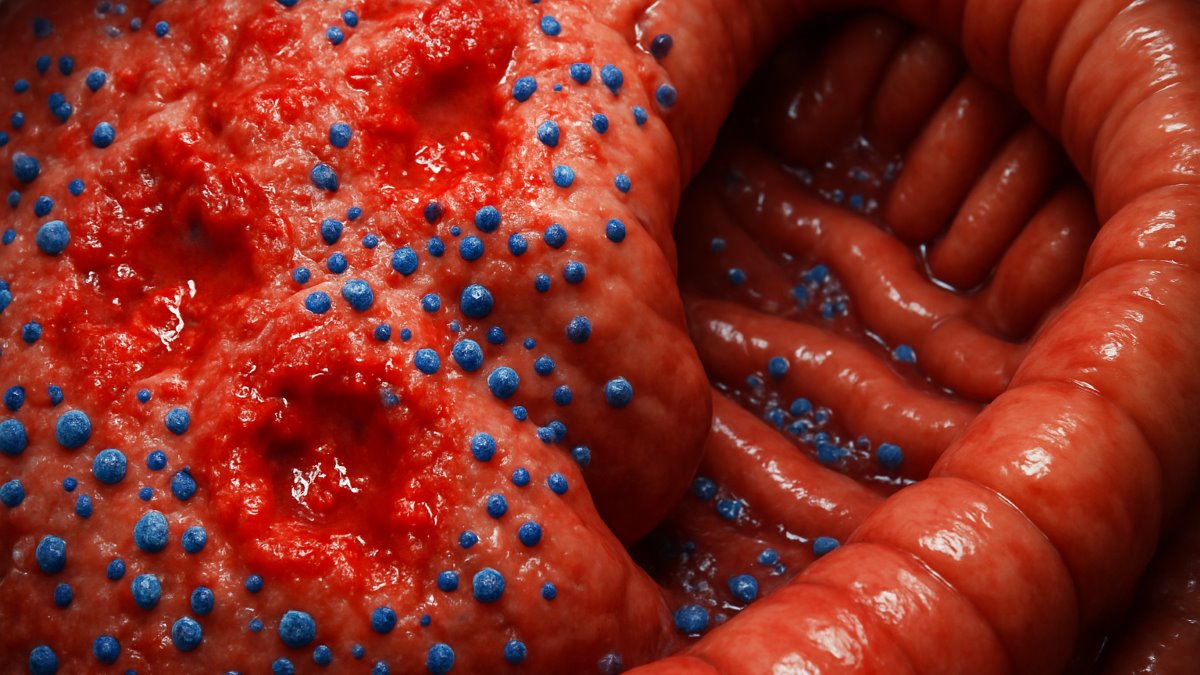 Zinc Nutritional Status, Mood States and Quality of Life in Diarrhea-Predominant Irritable Bowel Syndrome: A Case–Control Study